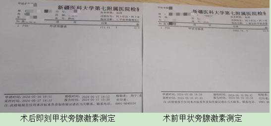 腎衰患者甲狀旁腺亢進，多學科聯合解除“刻骨”之痛